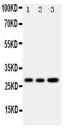 Anti-Oncostatin M/OSM Antibody Picoband® Boster Bio