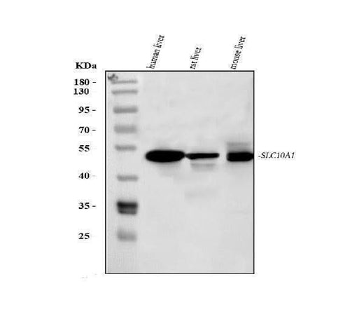 Anti-Sodium/bile acid cotransporter SLC10A1 Antibody Picoband® Boster Bio