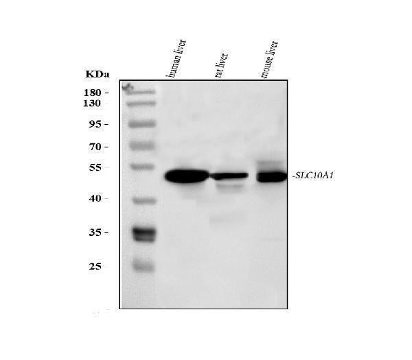Anti-Sodium/bile acid cotransporter SLC10A1 Antibody Picoband® Boster Bio