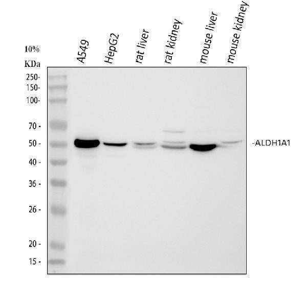 Anti-Retinal dehydrogenase 1 ALDH1A1 Antibody Picoband® Boster Bio