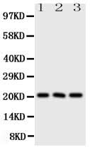 Anti-Fibroblast growth factor 21 FGF21 Antibody Picoband® Boster Bio