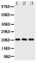 Anti-Fibroblast growth factor 21 FGF21 Antibody Picoband® Boster Bio
