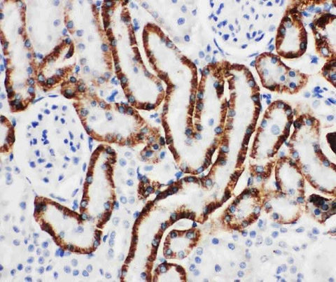 Anti-SLC22A6 Antibody Picoband® Boster Bio