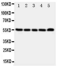 Anti-Neurokinin 1 Receptor/TACR1 Antibody Picoband® Boster Bio