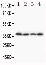 Anti-Stra8 Antibody Picoband® Boster Bio