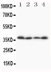 Anti-Stra8 Antibody Picoband® Boster Bio