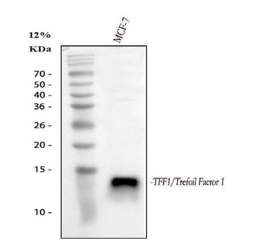 Anti-Estrogen Inducible Protein pS2/TFF1 Antibody Picoband® Boster Bio