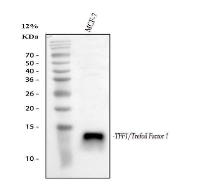 Anti-Estrogen Inducible Protein pS2/TFF1 Antibody Picoband® Boster Bio
