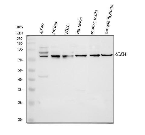 Anti-STAT4 Antibody Picoband® Boster Bio