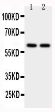 Anti-CYP11A1 Antibody Picoband® Boster Bio