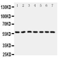 Anti-CYP11B1 Antibody Picoband® Boster Bio