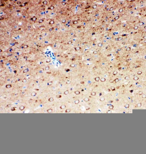 Anti-Serotonin transporter/SLC6A4 Antibody Picoband® Boster Bio