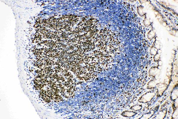Anti-MCM2 Antibody Picoband® Boster Bio