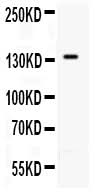 Anti-CD62P/SELP Antibody Picoband® Boster Bio