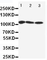 Anti-SERCA1 ATPase/ATP2A1 Antibody Picoband® Boster Bio