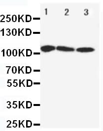 Anti-SERCA1 ATPase/ATP2A1 Antibody Picoband® Boster Bio