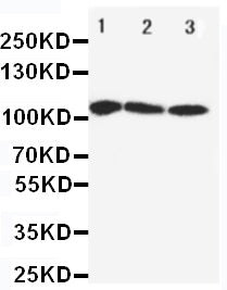 Anti-SERCA1 ATPase/ATP2A1 Antibody Picoband® Boster Bio