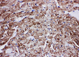 Anti-Glucose Transporter GLUT4/SLC2A4 Antibody Picoband® Boster Bio