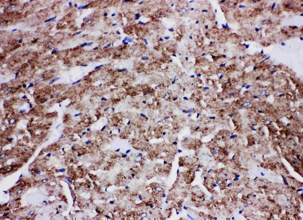 Anti-Glucose Transporter GLUT4/SLC2A4 Antibody Picoband® Boster Bio