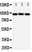 Anti-ABCB6 Antibody Picoband® Boster Bio