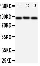 Anti-ABCB6 Antibody Picoband® Boster Bio