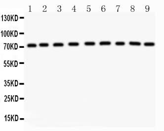 Anti-Growth hormone receptor/GHR Antibody Picoband® Boster Bio