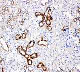 Anti-Glucose Transporter 5 GLUT5/SLC2A5 Antibody Picoband® Boster Bio