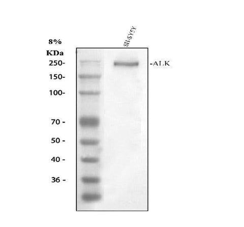 Anti-ALK Antibody Picoband® Boster Bio