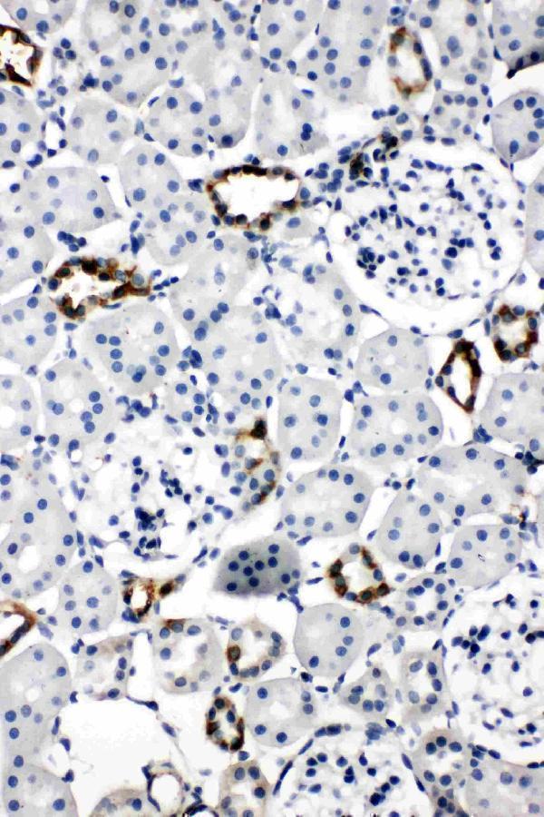 Anti-Aquaporin 2/AQP2 Antibody Picoband® Boster Bio