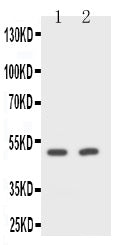 Anti-CD2/CD2 Antibody Picoband® Boster Bio