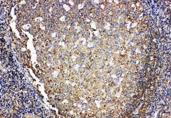 Anti-Interleukin-4 IL4 Antibody Picoband® Boster Bio