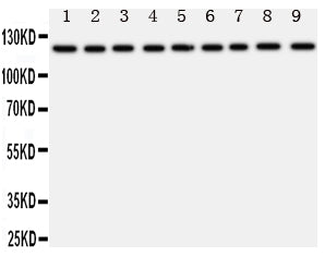 Anti-TRPC3 Antibody Picoband® Boster Bio