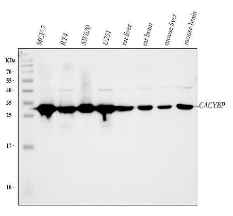 Anti-SIAH Interacting Protein/CACYBP Antibody Picoband® Boster Bio