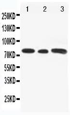 Anti-Transcriptional activator GLI3 Gli3 Antibody Picoband® Boster Bio