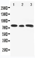 Anti-Transcriptional activator GLI3 Gli3 Antibody Picoband® Boster Bio