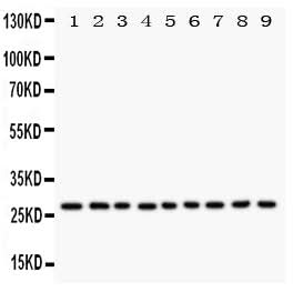 Anti-Kallikrein 6/KLK6 Antibody Picoband® Boster Bio