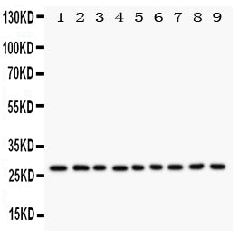Anti-Kallikrein 6/KLK6 Antibody Picoband® Boster Bio