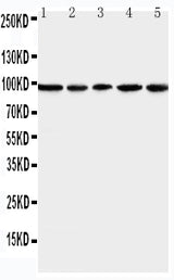 Anti-MCM6 Antibody Picoband® Boster Bio