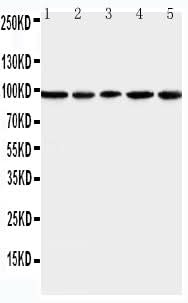 Anti-MCM6 Antibody Picoband® Boster Bio