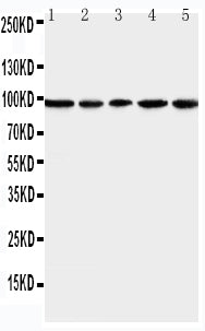 Anti-MCM6 Antibody Picoband® Boster Bio