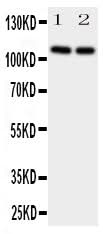 Anti-Neuropilin-2 NRP2 Antibody Picoband® Boster Bio