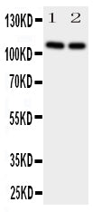 Anti-Neuropilin-2 NRP2 Antibody Picoband® Boster Bio