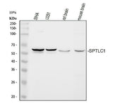 Anti-Serine palmitoyltransferase 1 SPTLC1 Antibody Picoband® Boster Bio