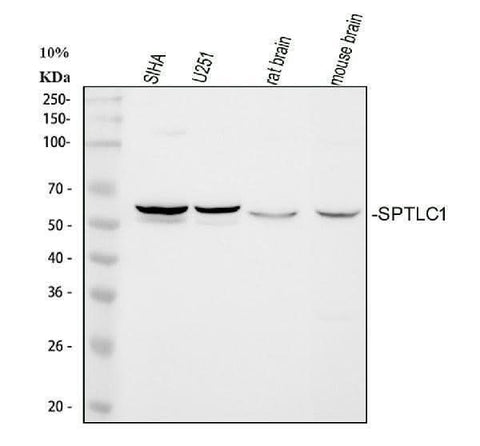 Anti-Serine palmitoyltransferase 1 SPTLC1 Antibody Picoband® Boster Bio