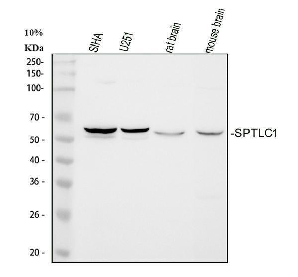 Anti-Serine palmitoyltransferase 1 SPTLC1 Antibody Picoband® Boster Bio