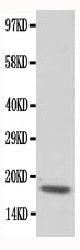 Anti-cardiac Troponin C/TNNC1 Antibody Picoband® Boster Bio