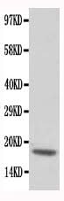 Anti-cardiac Troponin C/TNNC1 Antibody Picoband® Boster Bio