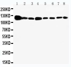 Anti-Vinculin/VCL Antibody Picoband® Boster Bio