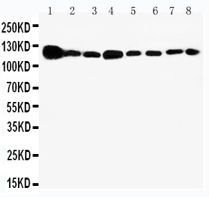 Anti-Vinculin/VCL Antibody Picoband® Boster Bio