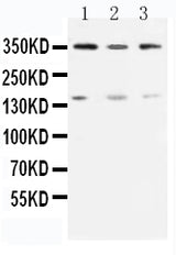 Anti-Serine-protein kinase ATM ATM Antibody Picoband® Boster Bio